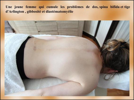 Douleurs de dos