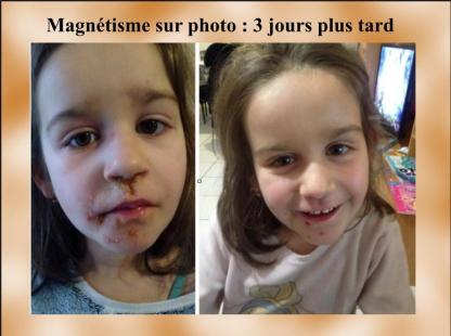 Herpes sur ambre par magnetisme 1